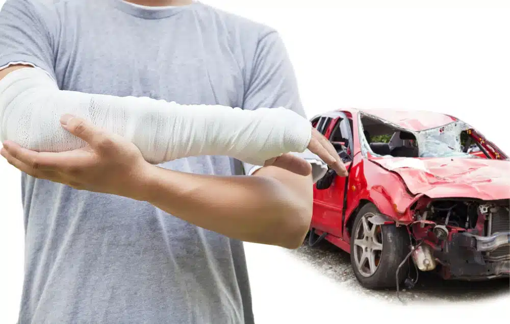 man with his arm in a cast standing in front of a wrecked car