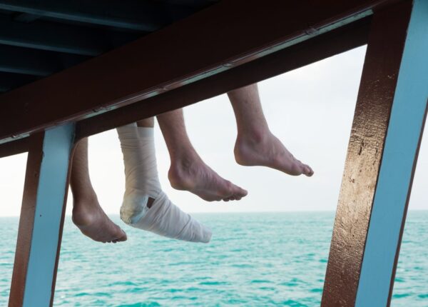 Injured in a Boating Accident