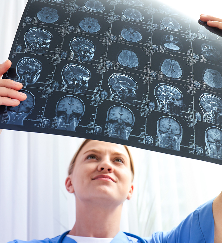 A young female doctor is looking at an MRI image of a human head brain injury attorney